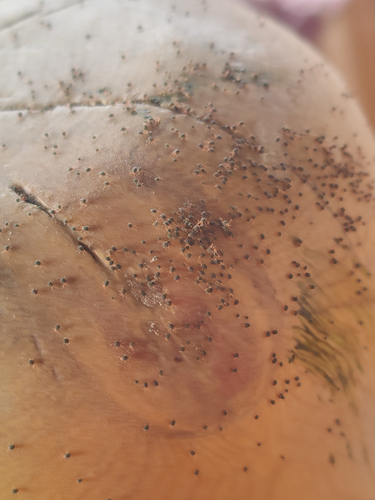 Larvae